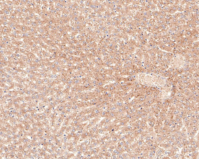 ACAT1 Antibody in Immunohistochemistry (Paraffin) (IHC (P))