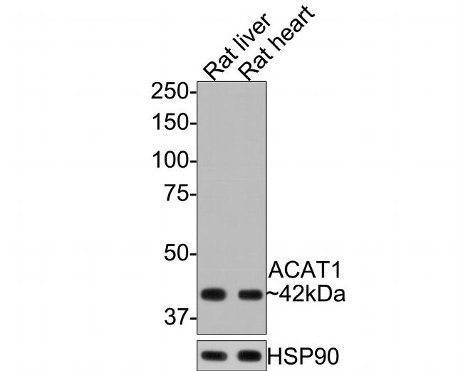 ACAT1 Antibody in Western Blot (WB)