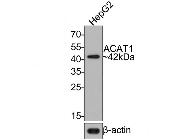 ACAT1 Antibody in Western Blot (WB)