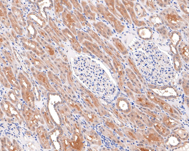 GALT Antibody in Immunohistochemistry (Paraffin) (IHC (P))