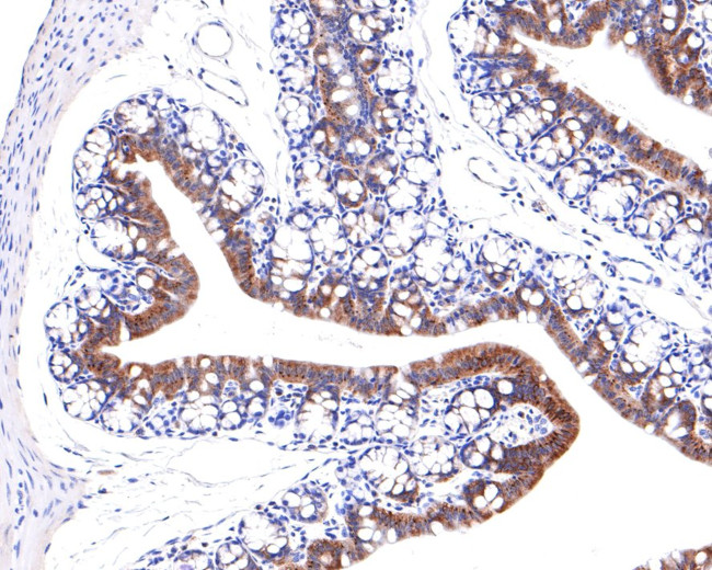 GALT Antibody in Immunohistochemistry (Paraffin) (IHC (P))