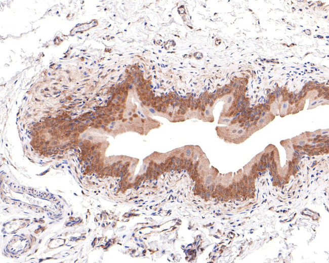 GALT Antibody in Immunohistochemistry (Paraffin) (IHC (P))