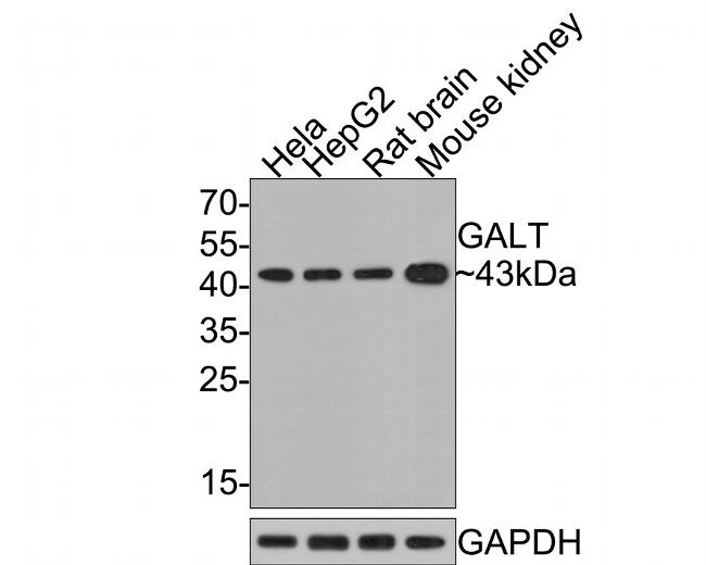 GALT Antibody in Western Blot (WB)