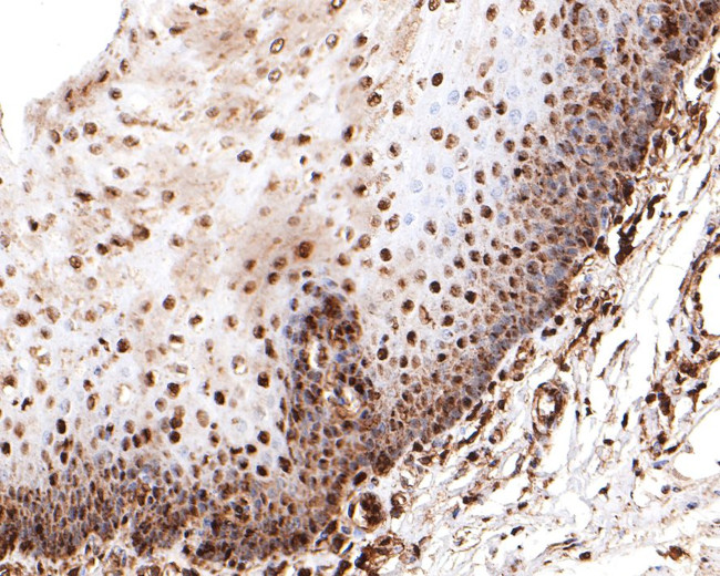 PRPF31 Antibody in Immunohistochemistry (Paraffin) (IHC (P))