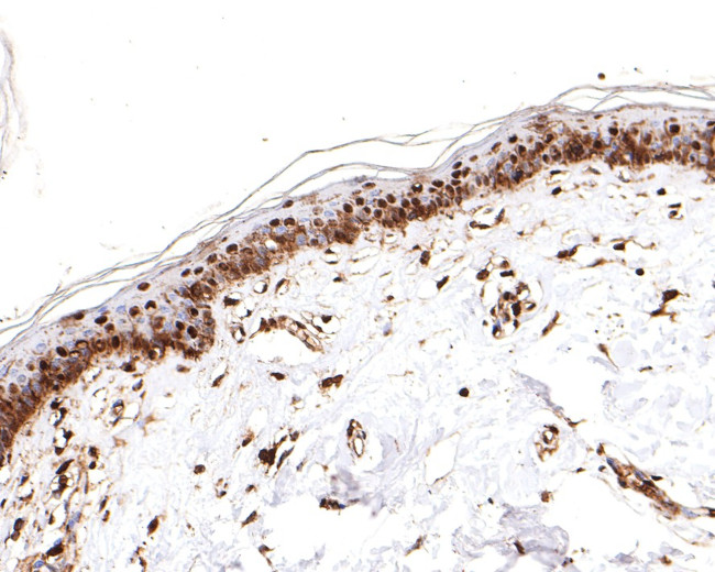 PRPF31 Antibody in Immunohistochemistry (Paraffin) (IHC (P))