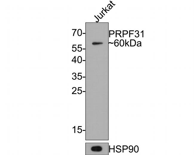 PRPF31 Antibody in Western Blot (WB)