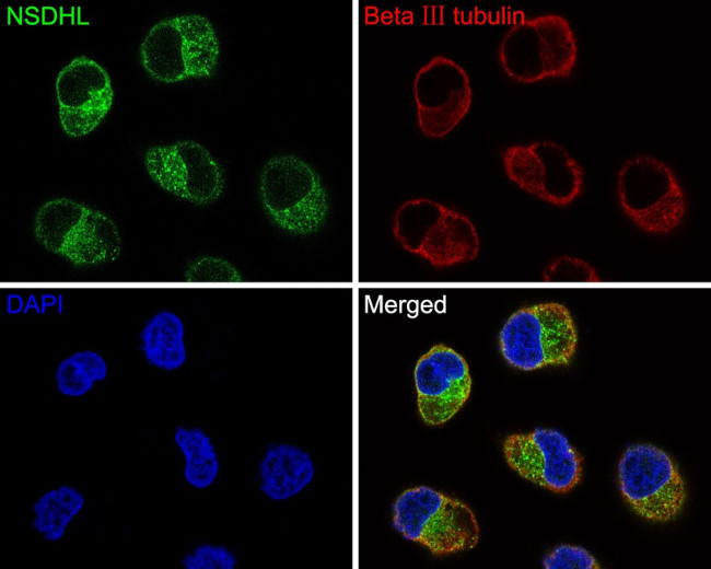 NSDHL Antibody in Immunocytochemistry (ICC/IF)