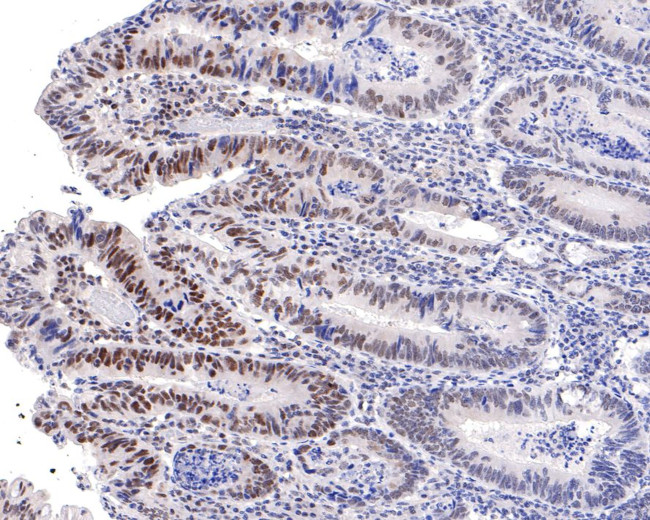 PNK Antibody in Immunohistochemistry (Paraffin) (IHC (P))