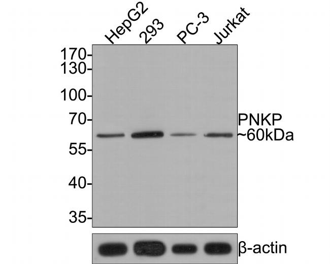 PNK Antibody in Western Blot (WB)