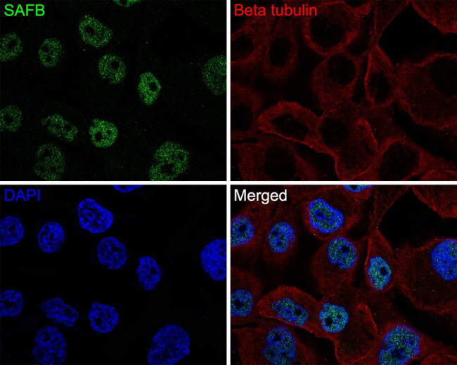 SAFB Antibody in Immunocytochemistry (ICC/IF)