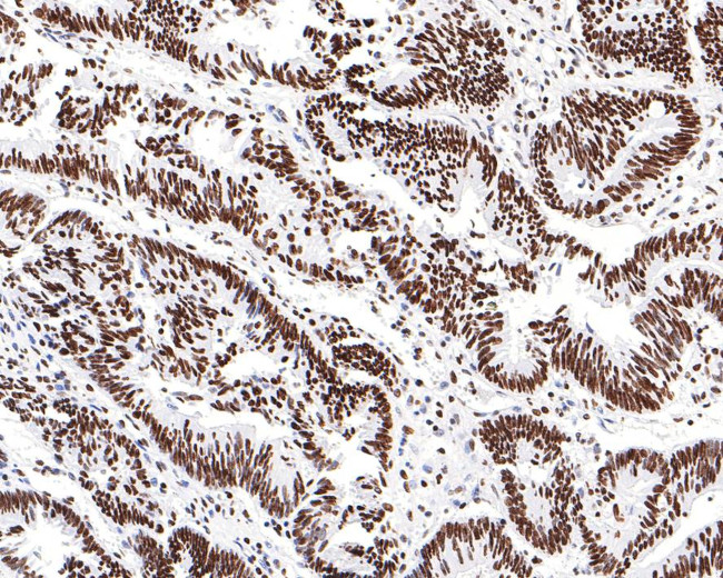 SAFB Antibody in Immunohistochemistry (Paraffin) (IHC (P))