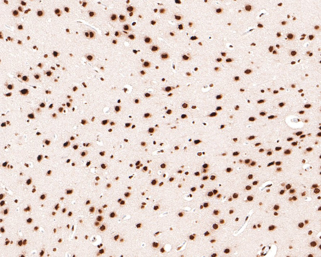 SAFB Antibody in Immunohistochemistry (Paraffin) (IHC (P))