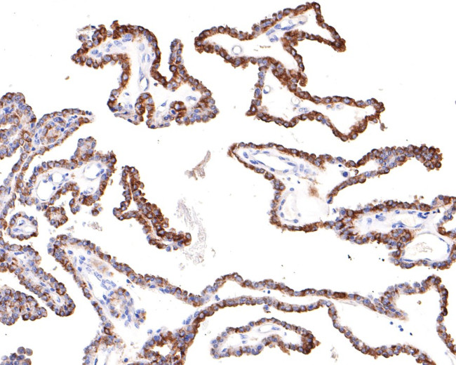 SNX5 Antibody in Immunohistochemistry (Paraffin) (IHC (P))