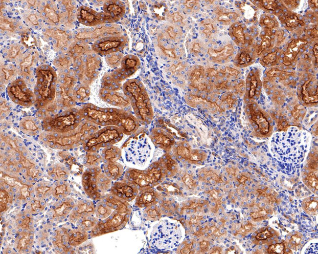 SNX5 Antibody in Immunohistochemistry (Paraffin) (IHC (P))