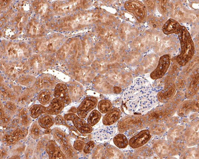 SNX5 Antibody in Immunohistochemistry (Paraffin) (IHC (P))