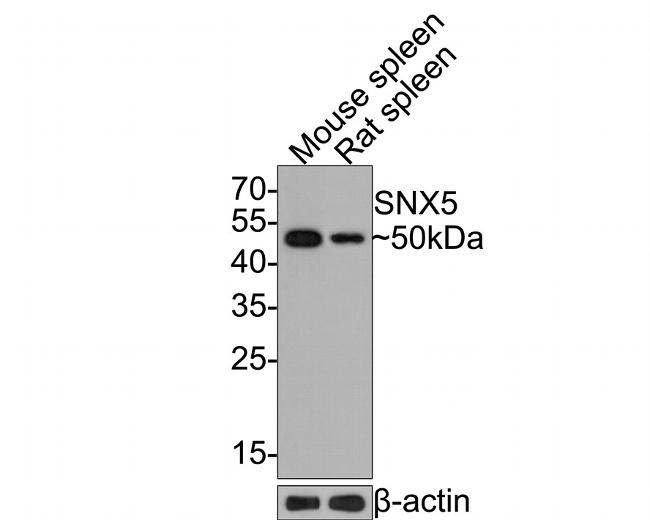 SNX5 Antibody in Western Blot (WB)