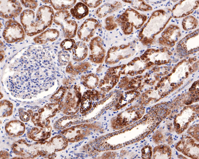 NDUFS2 Antibody in Immunohistochemistry (Paraffin) (IHC (P))