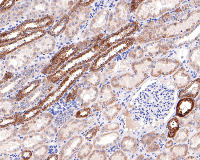 HAUS7 Antibody in Immunohistochemistry (Paraffin) (IHC (P))