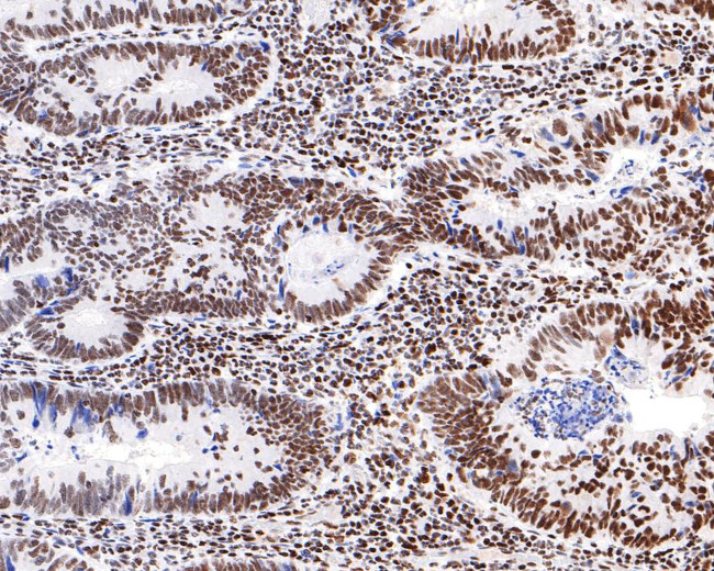 NUP50 Antibody in Immunohistochemistry (Paraffin) (IHC (P))