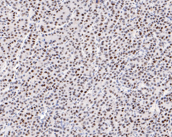 NUP50 Antibody in Immunohistochemistry (Paraffin) (IHC (P))