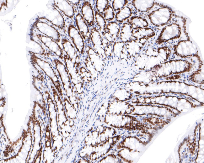 NUP50 Antibody in Immunohistochemistry (Paraffin) (IHC (P))