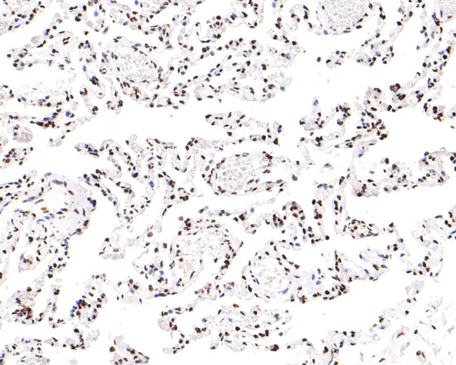 Nucleolin Antibody in Immunohistochemistry (Paraffin) (IHC (P))