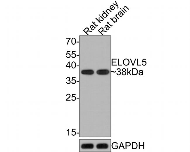 ELOVL5 Antibody in Western Blot (WB)