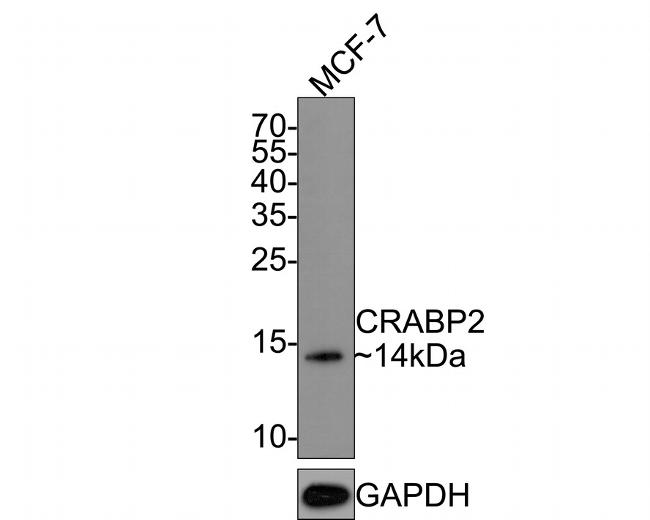 CRABP2 Antibody in Western Blot (WB)