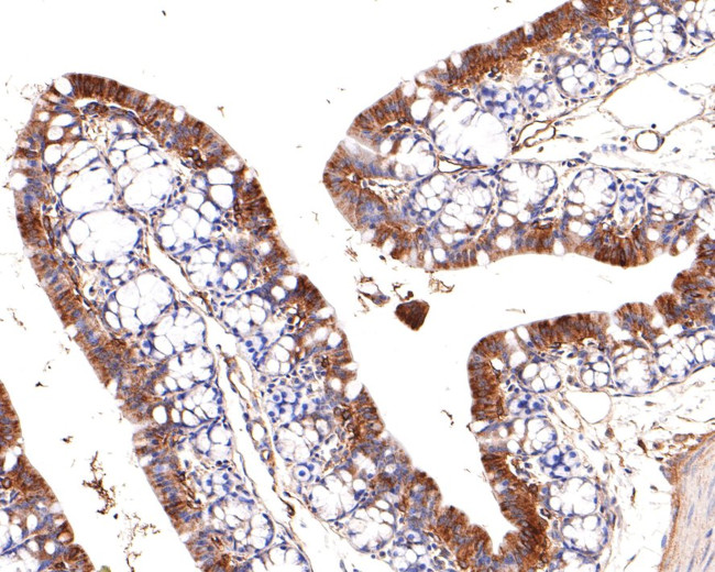 Adiponectin Antibody in Immunohistochemistry (Paraffin) (IHC (P))