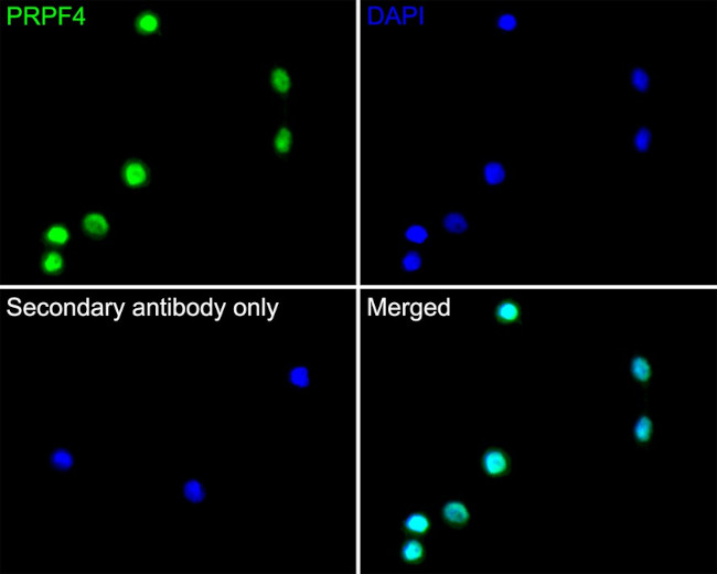 PRPF4 Antibody in Immunocytochemistry (ICC/IF)