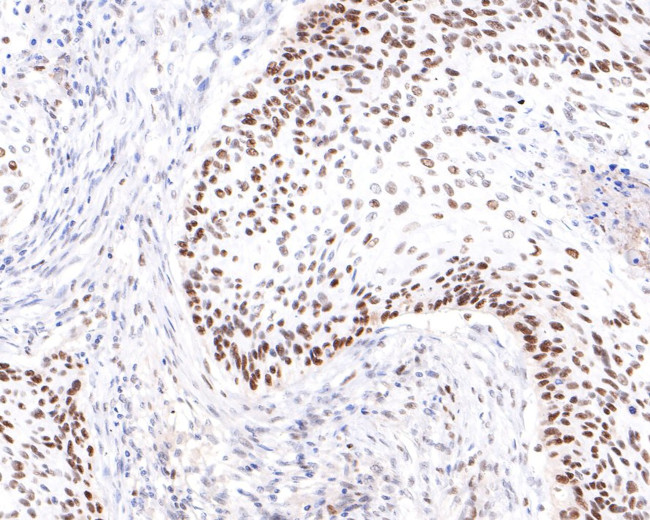 PRPF4 Antibody in Immunohistochemistry (Paraffin) (IHC (P))