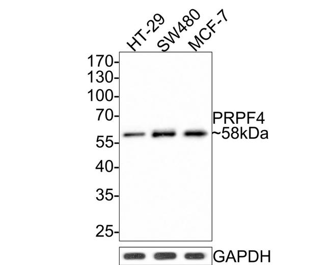 PRPF4 Antibody in Western Blot (WB)