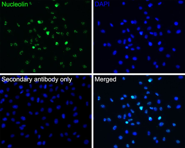 CRCP Antibody in Immunocytochemistry (ICC/IF)