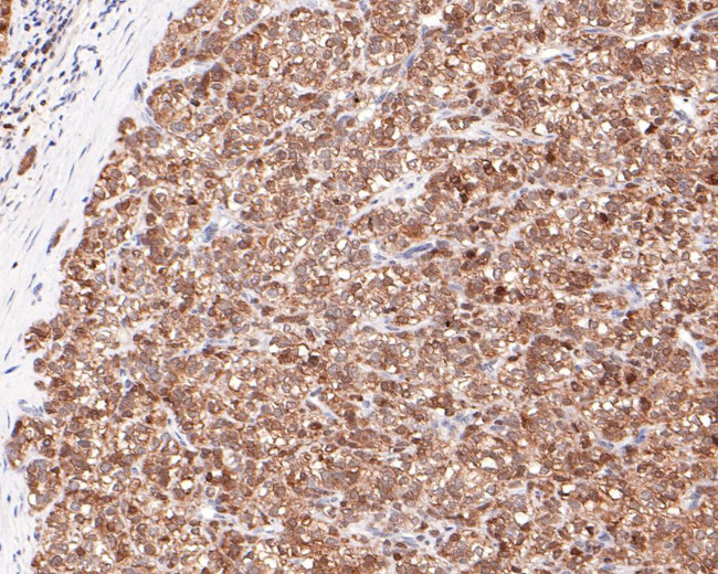 CRCP Antibody in Immunohistochemistry (Paraffin) (IHC (P))