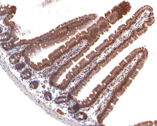 CRCP Antibody in Immunohistochemistry (Paraffin) (IHC (P))