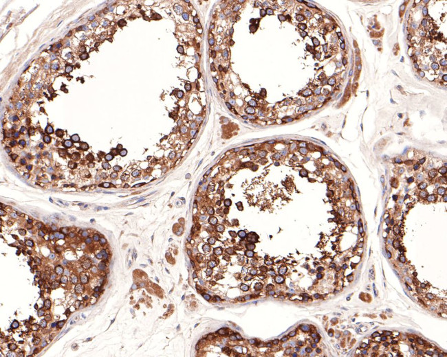 VDP Antibody in Immunohistochemistry (Paraffin) (IHC (P))