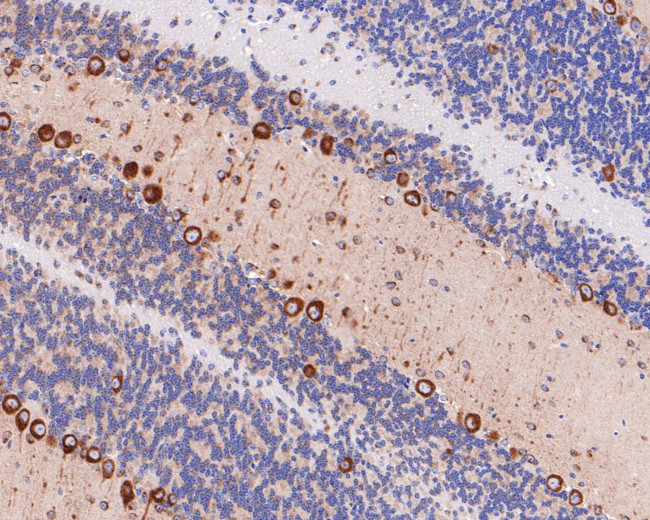 VDP Antibody in Immunohistochemistry (Paraffin) (IHC (P))