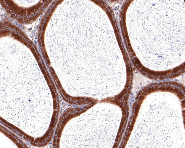 VDP Antibody in Immunohistochemistry (Paraffin) (IHC (P))