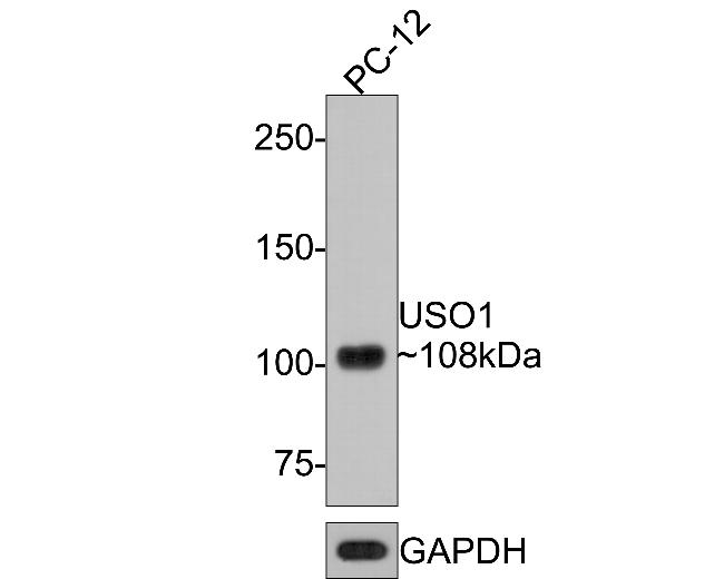 VDP Antibody in Western Blot (WB)