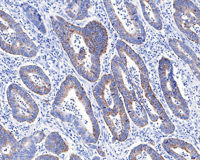 ACADS Antibody in Immunohistochemistry (Paraffin) (IHC (P))