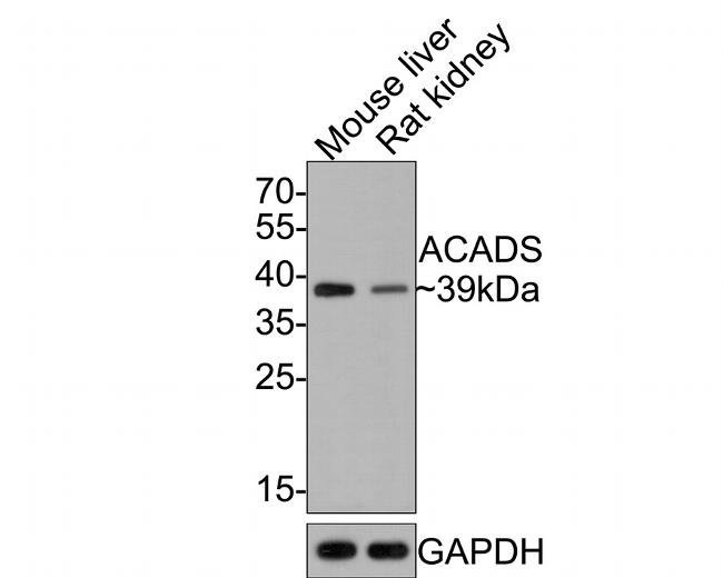ACADS Antibody in Western Blot (WB)