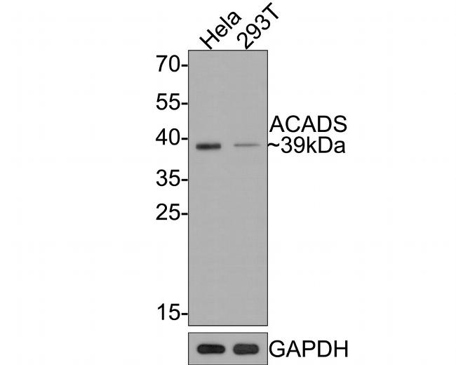 ACADS Antibody in Western Blot (WB)