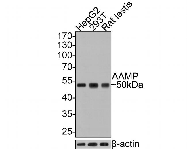 AAMP Antibody in Western Blot (WB)