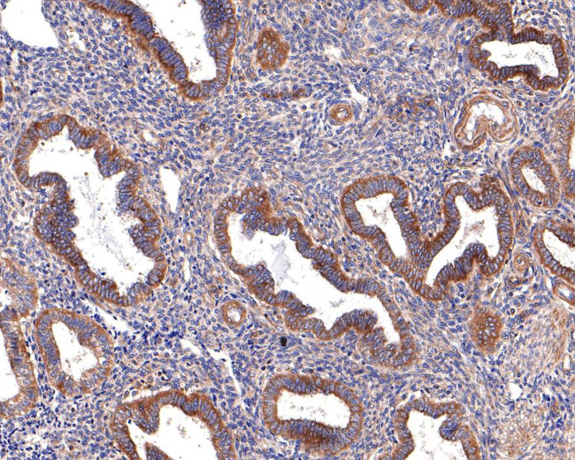 WDR1 Antibody in Immunohistochemistry (Paraffin) (IHC (P))