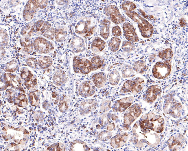 WDR1 Antibody in Immunohistochemistry (Paraffin) (IHC (P))