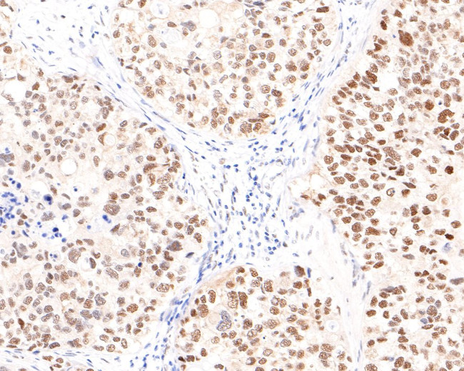 TRIM24 Antibody in Immunohistochemistry (Paraffin) (IHC (P))