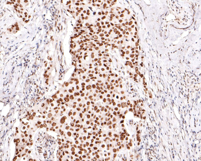 TRIM24 Antibody in Immunohistochemistry (Paraffin) (IHC (P))