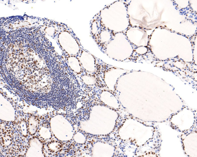 TRIM24 Antibody in Immunohistochemistry (Paraffin) (IHC (P))