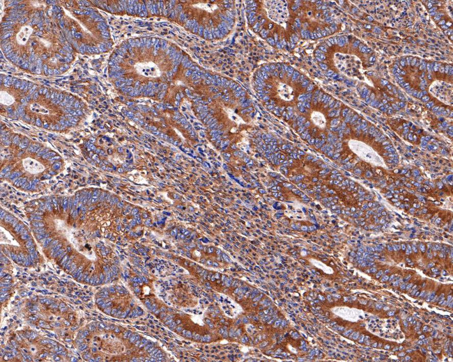 ACTR1B Antibody in Immunohistochemistry (Paraffin) (IHC (P))