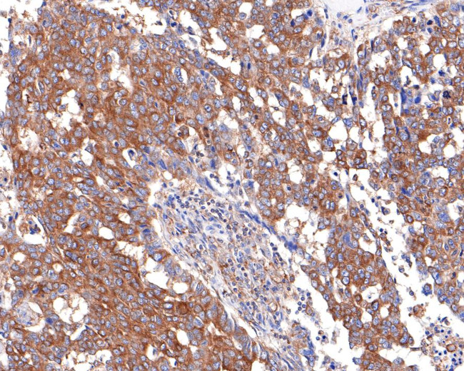 ACTR1B Antibody in Immunohistochemistry (Paraffin) (IHC (P))